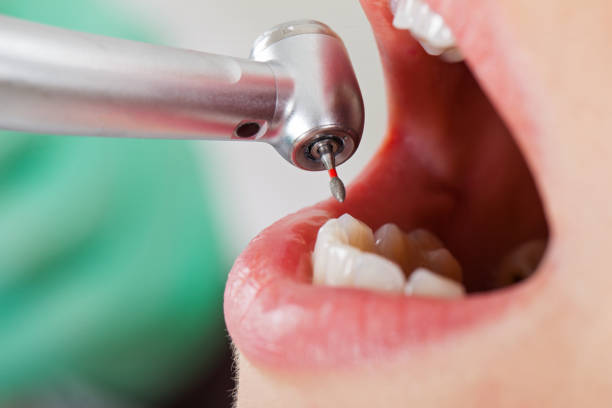 Best Weekend Emergency Dentist in Middlefield, OH